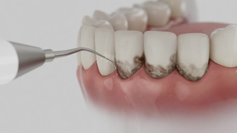 Trusted Dental Implants service in Biltmore Forest, NC - Dentist Open Now